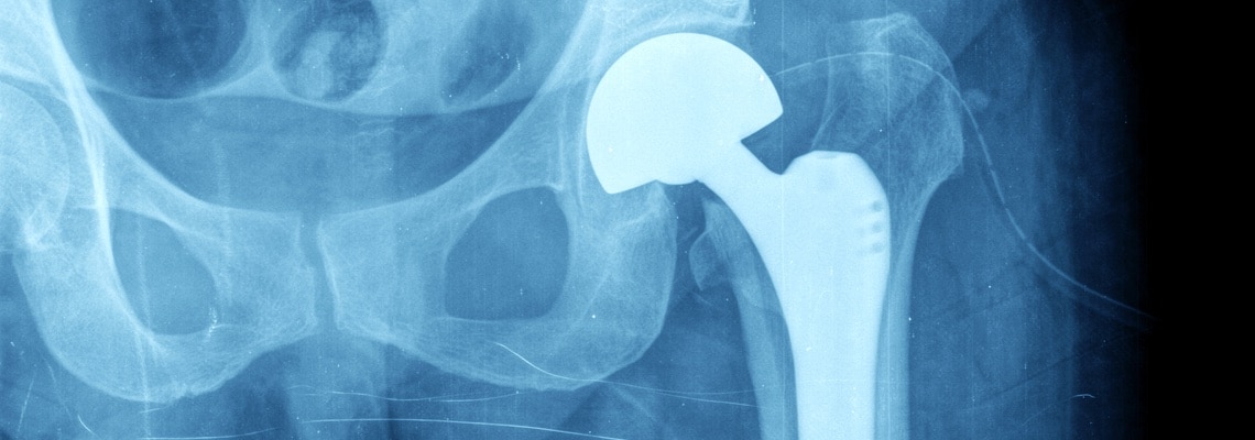 Image of jordi labs polymer failure analysis
