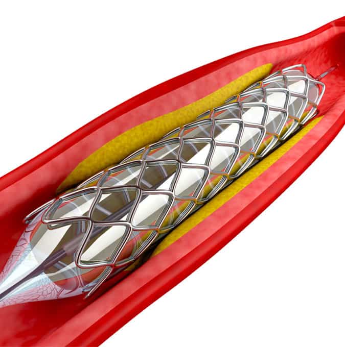 乔di Labs specializes in E&L testing for medical devices