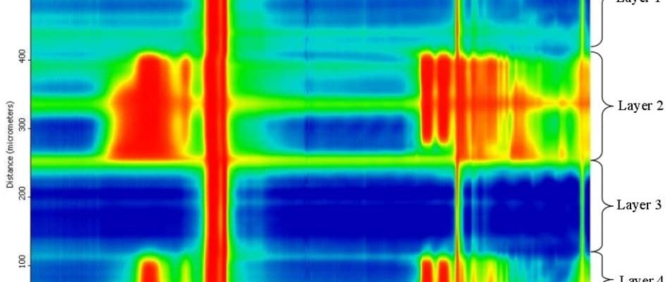 来自案例研究的图像：识别血袋的胶片层